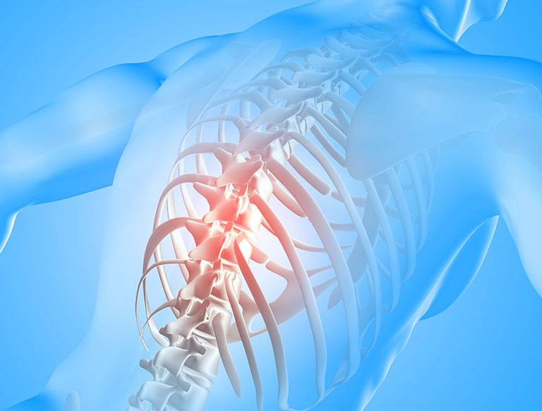 Full Endoscopic Thoracic Discectomy Asian Spine Hospital